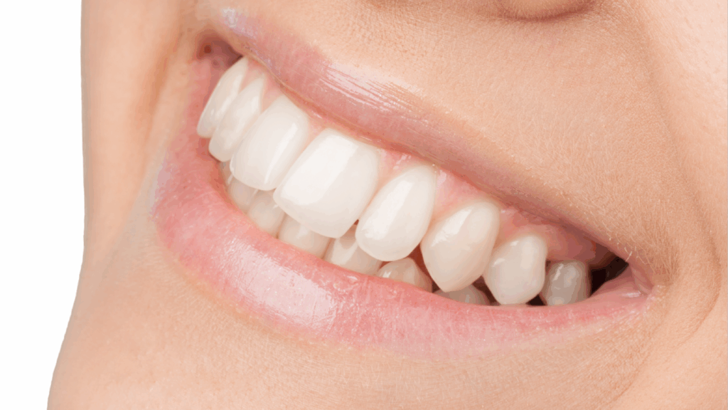 lentes em resinas tratamento odonto smart na serra