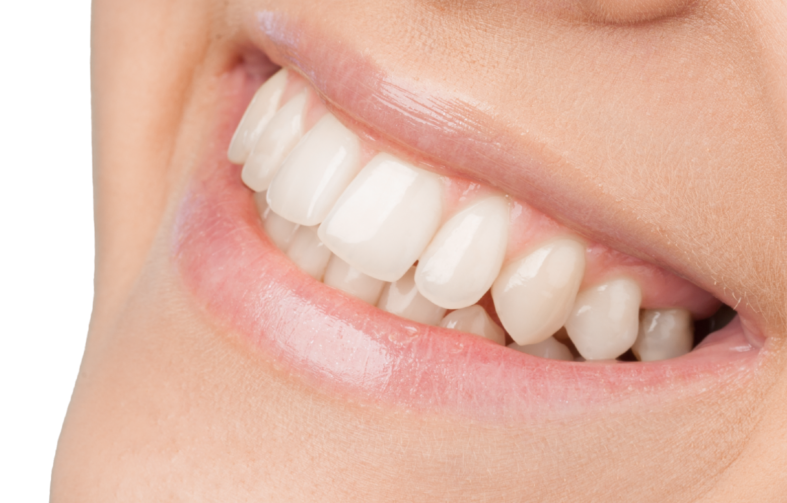 tratamentos odonto smart serra laranjeiras lentes de resinas