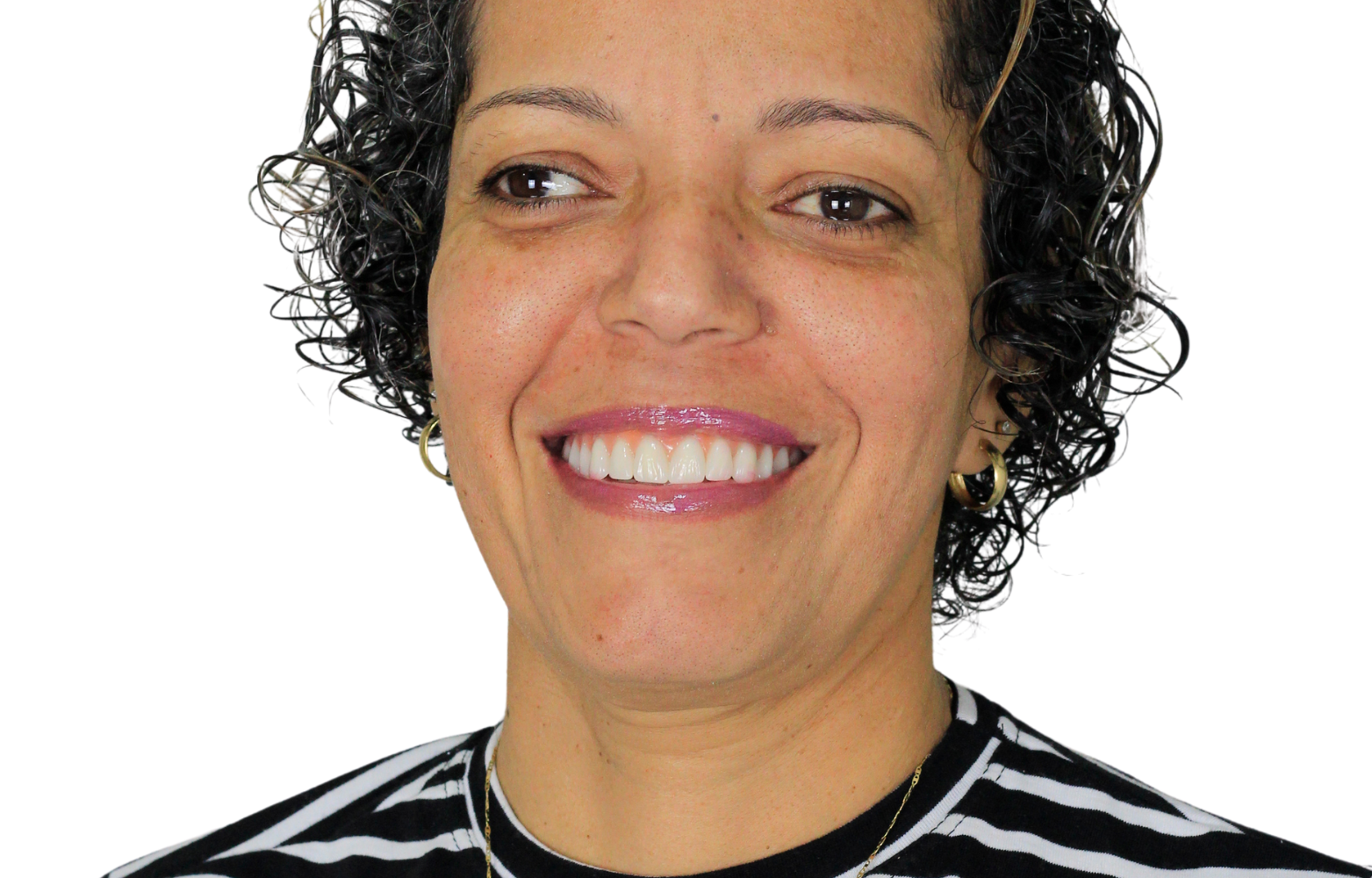 tratamentos odonto smart serra laranjeiras protese protocolo